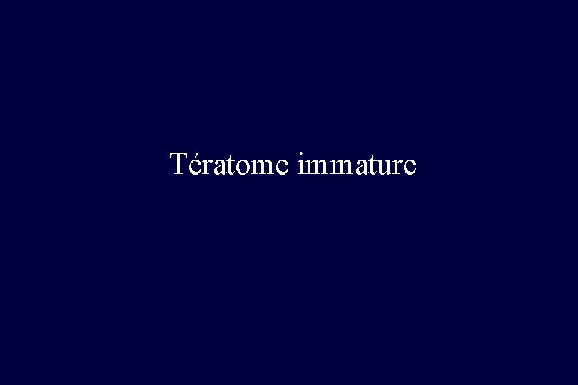 Tératome immature 