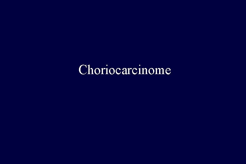 Choriocarcinome 