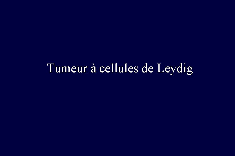 Tumeur à cellules de Leydig 