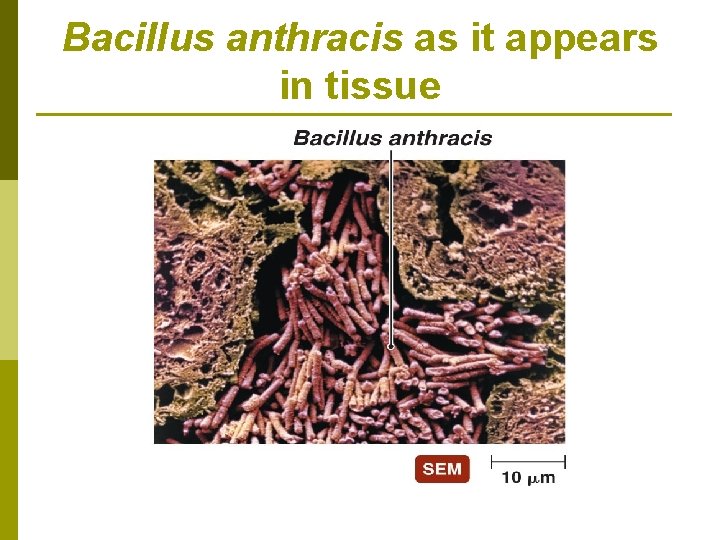Bacillus anthracis as it appears in tissue 