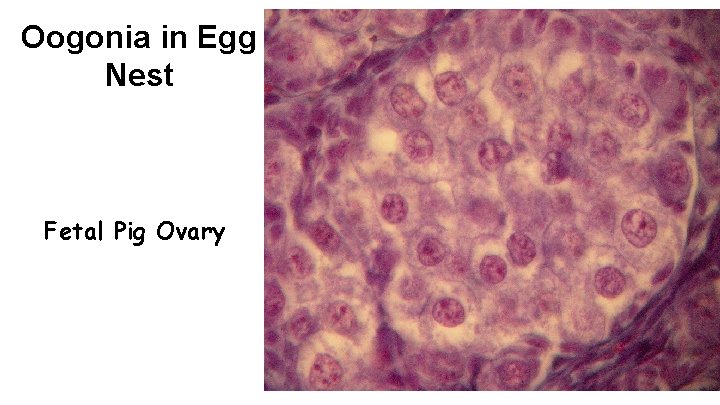 Oogonia in Egg Nest Fetal Pig Ovary 