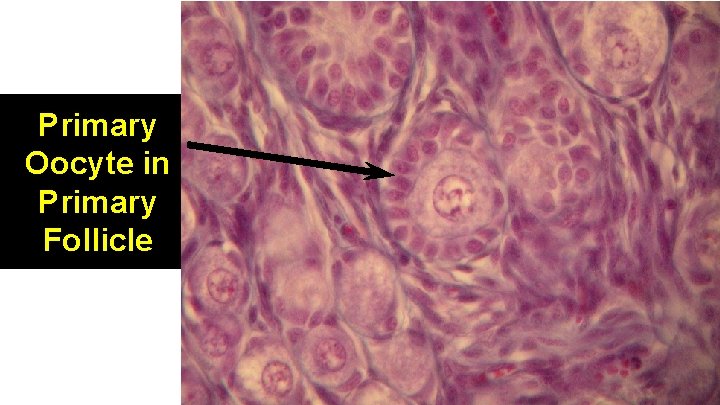 Primary Oocyte in Primary Follicle 