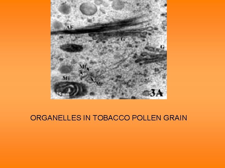 ORGANELLES IN TOBACCO POLLEN GRAIN 