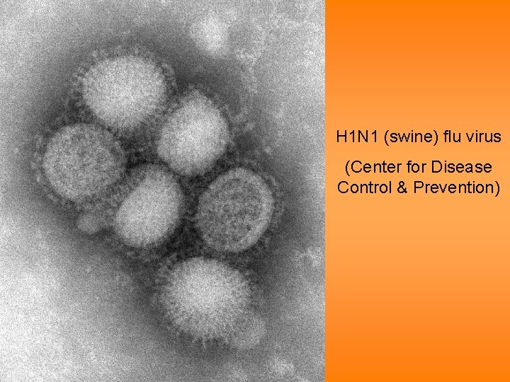 H 1 N 1 (swine) flu virus (Center for Disease Control & Prevention) 