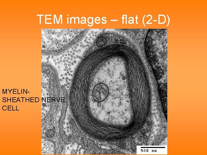 TEM images – flat (2 -D) MYELINSHEATHED NERVE CELL 