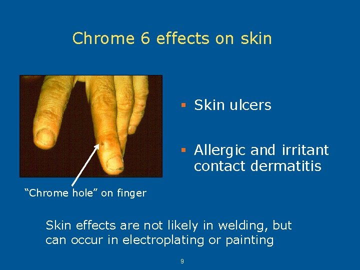 Chrome 6 effects on skin § Skin ulcers § Allergic and irritant contact dermatitis Chrome 6 effects on skin § Skin ulcers § Allergic and irritant contact dermatitis