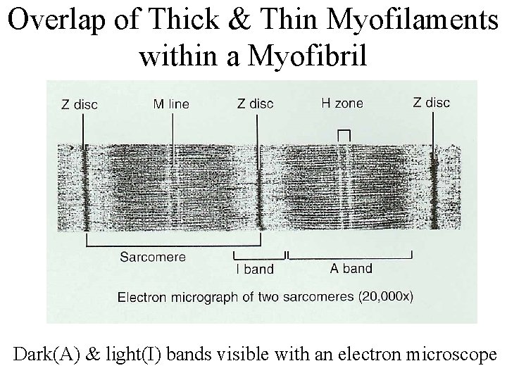 Overlap of Thick & Thin Myofilaments within a Myofibril Dark(A) & light(I) bands visible