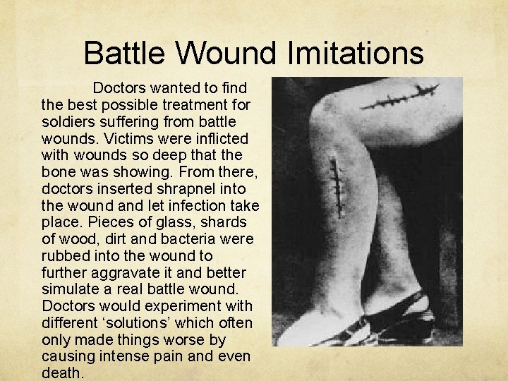 Battle Wound Imitations Doctors wanted to find the best possible treatment for soldiers suffering