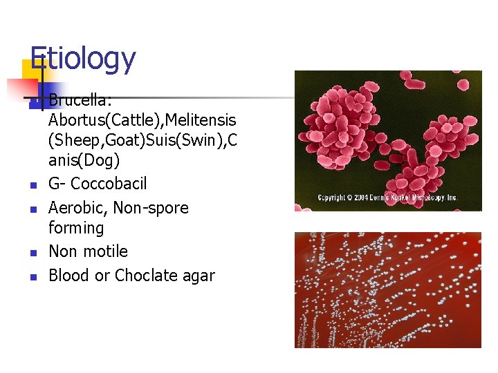Etiology n n n Brucella: Abortus(Cattle), Melitensis (Sheep, Goat)Suis(Swin), C anis(Dog) G- Coccobacil Aerobic, Etiology n n n Brucella: Abortus(Cattle), Melitensis (Sheep, Goat)Suis(Swin), C anis(Dog) G- Coccobacil Aerobic,