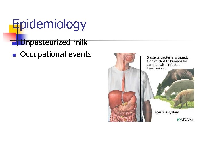 Epidemiology n n Unpasteurized milk Occupational events Epidemiology n n Unpasteurized milk Occupational events
