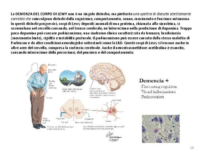 La DEMENZA DEL CORPO DI LEWY non è un singolo disturbo, ma piuttosto uno