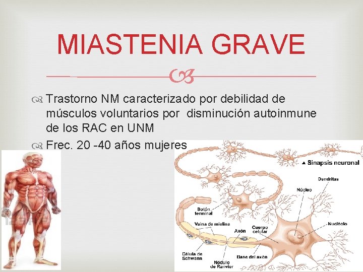 MIASTENIA GRAVE Trastorno NM caracterizado por debilidad de músculos voluntarios por disminución autoinmune de