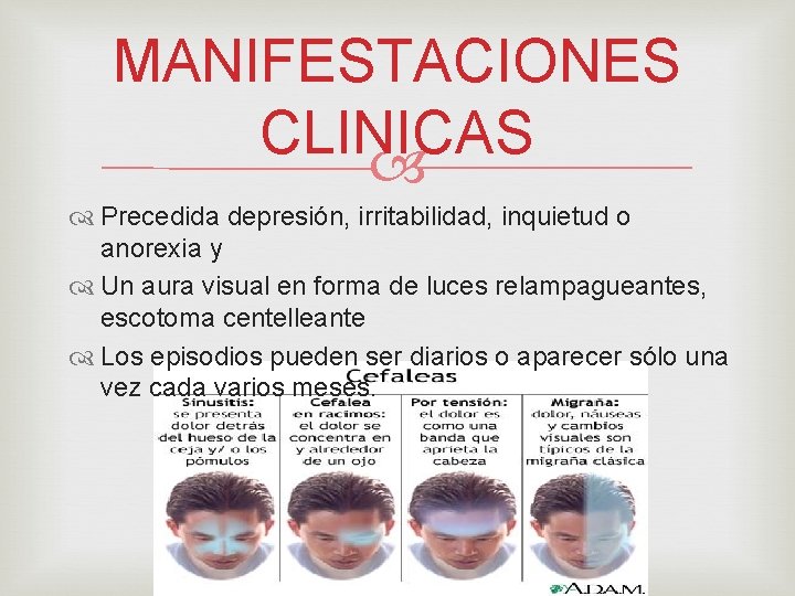 MANIFESTACIONES CLINICAS Precedida depresión, irritabilidad, inquietud o anorexia y Un aura visual en forma