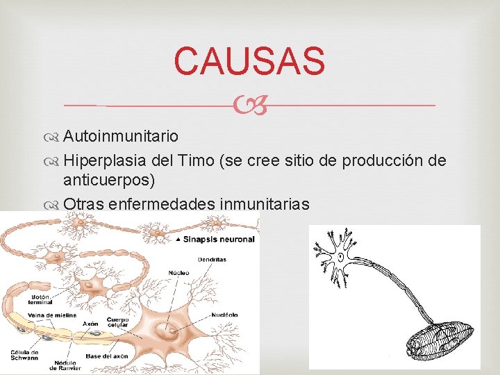 CAUSAS Autoinmunitario Hiperplasia del Timo (se cree sitio de producción de anticuerpos) Otras enfermedades