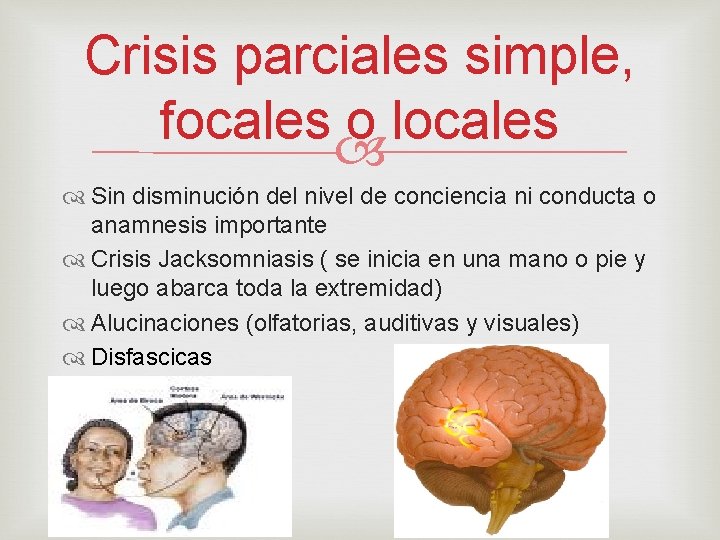 Crisis parciales simple, focales o locales Sin disminución del nivel de conciencia ni conducta