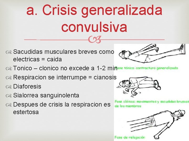 a. Crisis generalizada convulsiva Sacudidas musculares breves como electricas = caida Tonico – clonico