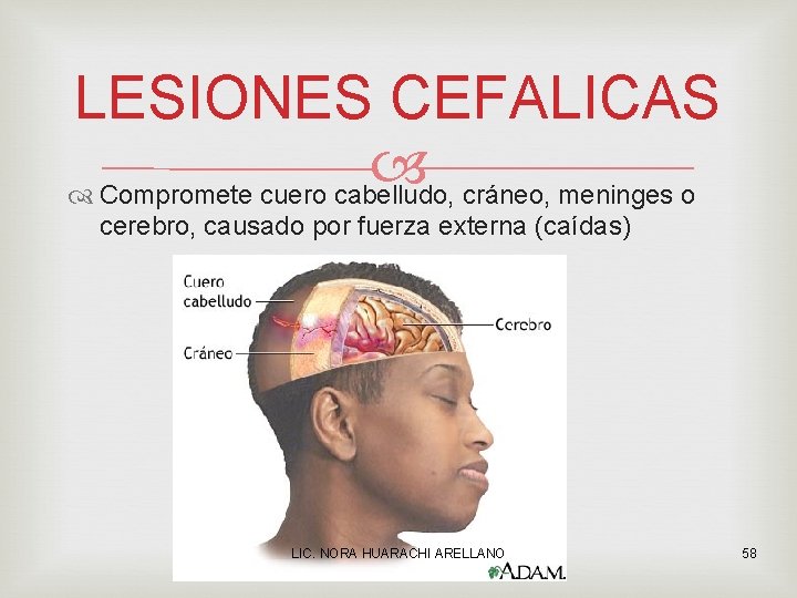 LESIONES CEFALICAS Compromete cuero cabelludo, cráneo, meninges o cerebro, causado por fuerza externa (caídas)
