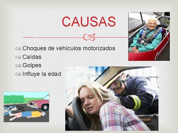 CAUSAS Choques de vehículos motorizados Caídas Golpes Influye la edad 