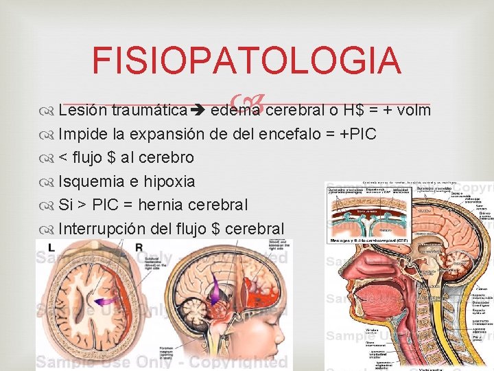 FISIOPATOLOGIA cerebral o H$ = + volm Lesión traumática edema Impide la expansión de