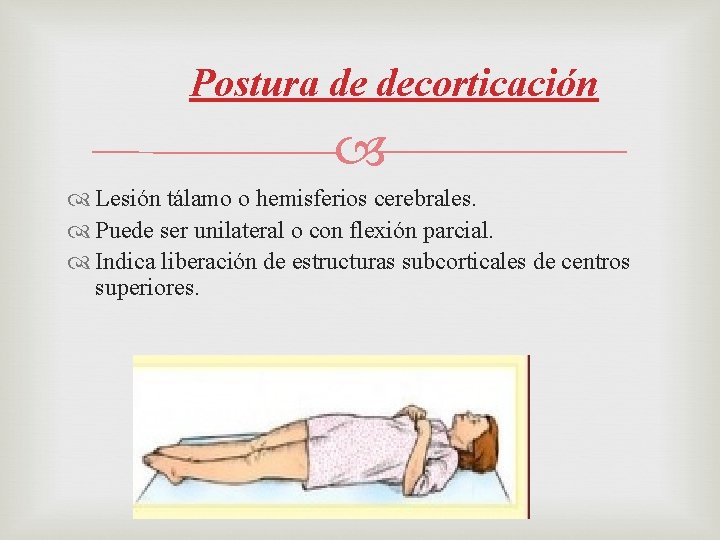 Postura de decorticación Lesión tálamo o hemisferios cerebrales. Puede ser unilateral o con flexión