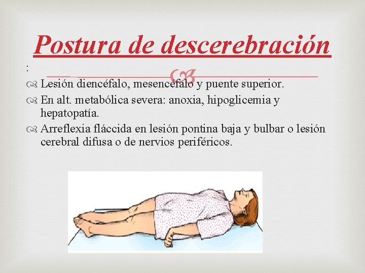 Postura de descerebración : y puente superior. Lesión diencéfalo, mesencéfalo En alt. metabólica severa: