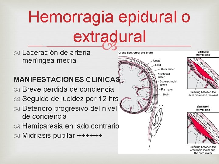 Hemorragia epidural o extradural Laceración de arteria meníngea media MANIFESTACIONES CLINICAS Breve perdida de