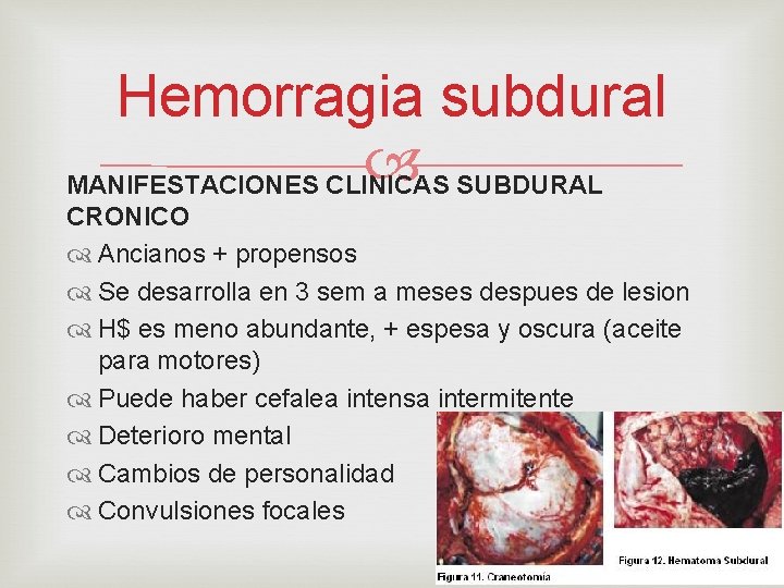 Hemorragia subdural MANIFESTACIONES CLINICAS SUBDURAL CRONICO Ancianos + propensos Se desarrolla en 3 sem