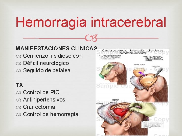 Hemorragia intracerebral MANIFESTACIONES CLINICAS Comienzo insidioso con Déficit neurológico Seguido de cefalea TX Control