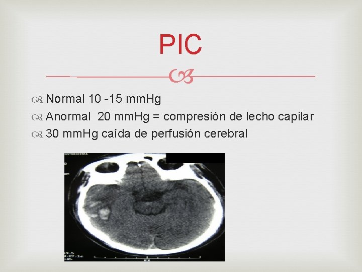 PIC Normal 10 -15 mm. Hg Anormal 20 mm. Hg = compresión de lecho