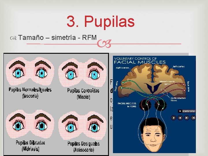 3. Pupilas Tamaño – simetría - RFM 