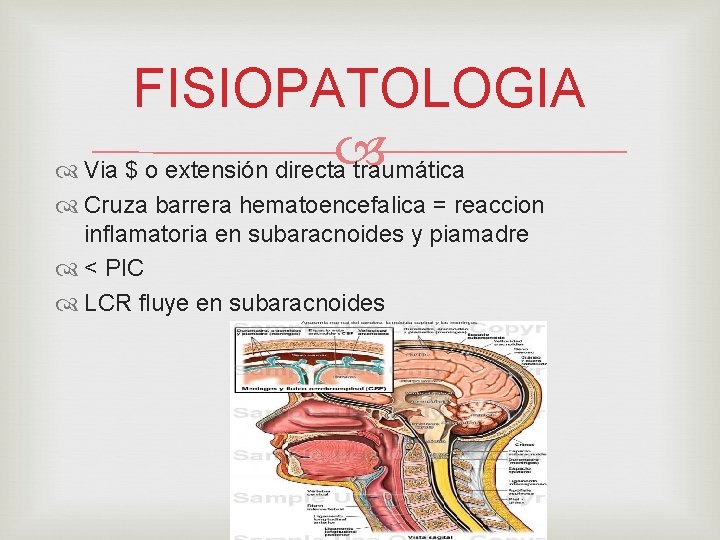 FISIOPATOLOGIA Via $ o extensión directa traumática Cruza barrera hematoencefalica = reaccion inflamatoria en