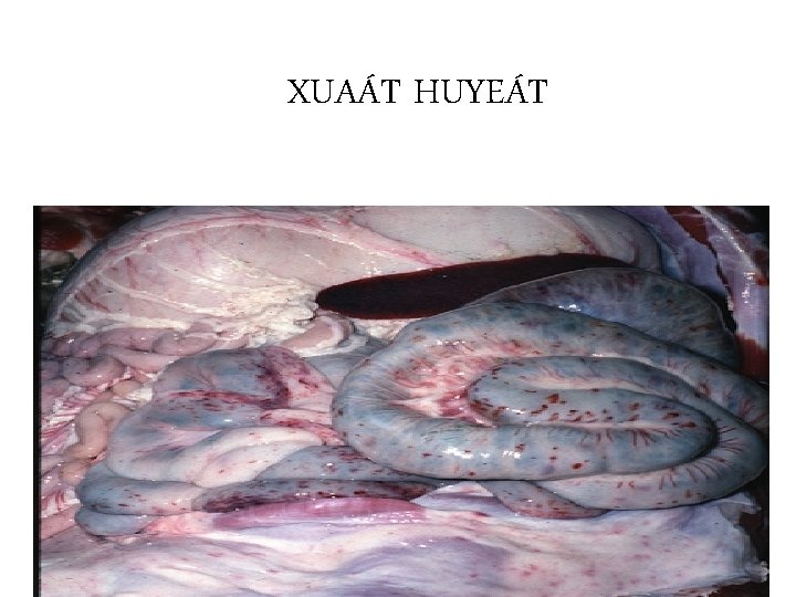 XUAÁT HUYEÁT 