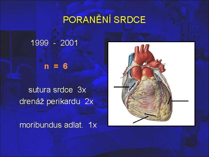 PORANĚNÍ SRDCE 1999 - 2001 n = 6 sutura srdce 3 x drenáž perikardu