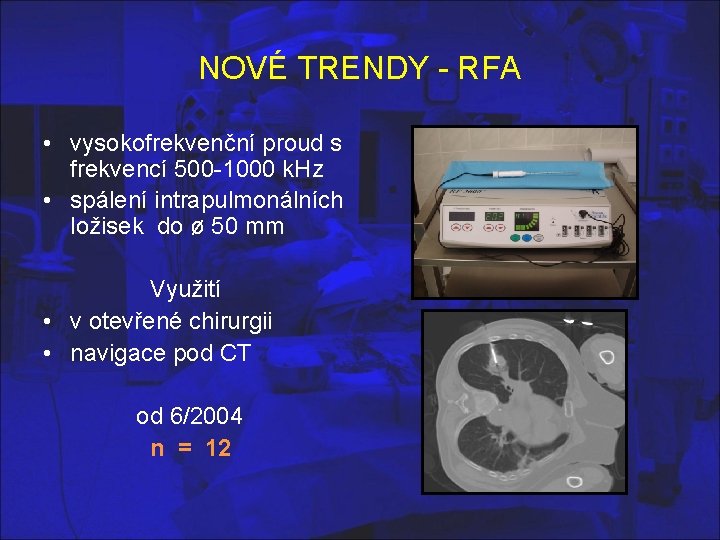NOVÉ TRENDY - RFA • vysokofrekvenční proud s frekvencí 500 -1000 k. Hz •