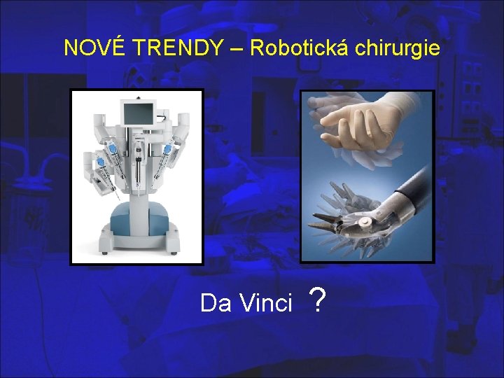 NOVÉ TRENDY – Robotická chirurgie Da Vinci ? 