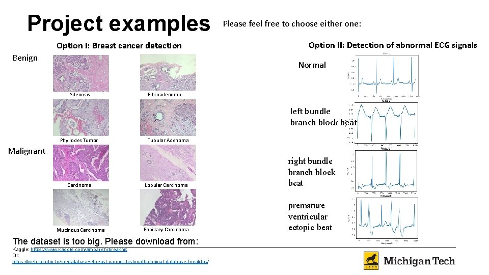 Project examples Option I: Breast cancer detection Benign Please feel free to choose either