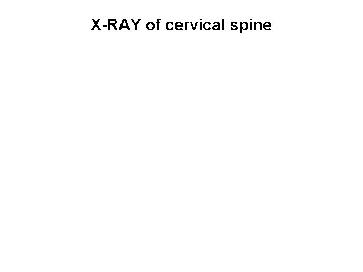 X-RAY of cervical spine 