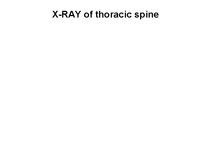 X-RAY of thoracic spine 