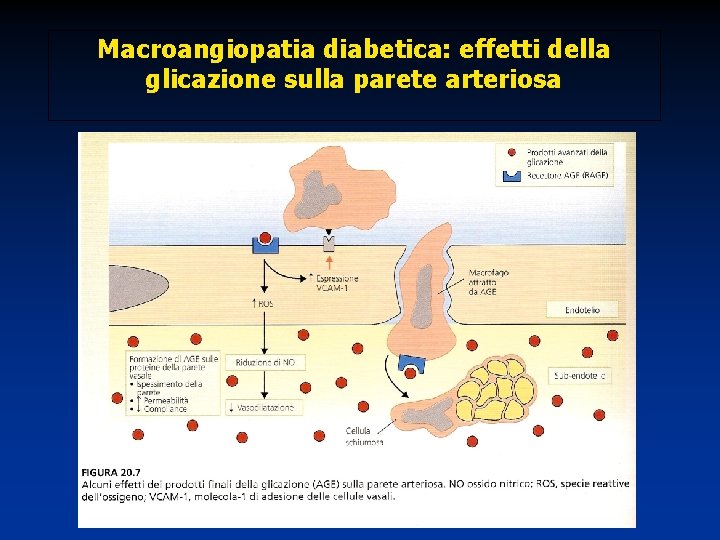 Macroangiopatia diabetica: effetti della glicazione sulla parete arteriosa 