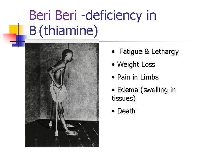 Beri -deficiency in B (thiamine) 1 • Fatigue & Lethargy • Weight Loss •