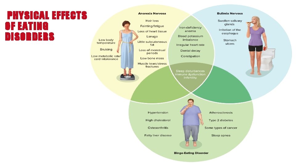 Eating Disorders What Would You Choose Your College