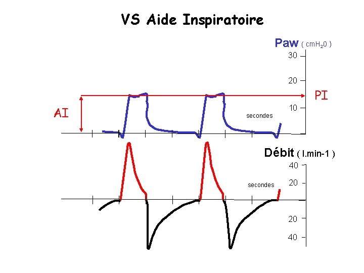 VS Aide Inspiratoire Paw ( cm. H 0 ) 2 30 20 PI AI