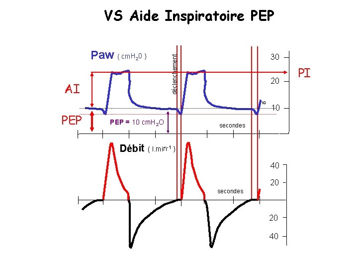 VS Aide Inspiratoire PEP 2 AI 30 déclenchement Paw ( cm. H 0 )