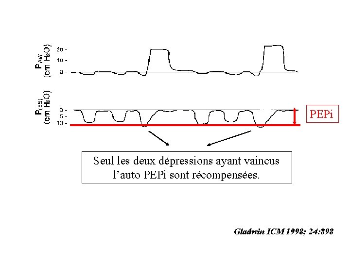 PEPi Seul les deux dépressions ayant vaincus l’auto PEPi sont récompensées. Gladwin ICM 1998;