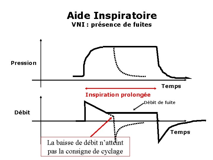 Aide Inspiratoire VNI : présence de fuites Pression Temps Inspiration prolongée Débit de fuite