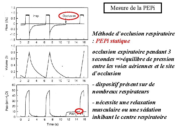 Mesure de la PEPi Méthode d’occlusion respiratoire : PEPi statique occlusion expiratoire pendant 3