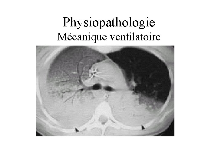 Physiopathologie Mécanique ventilatoire 