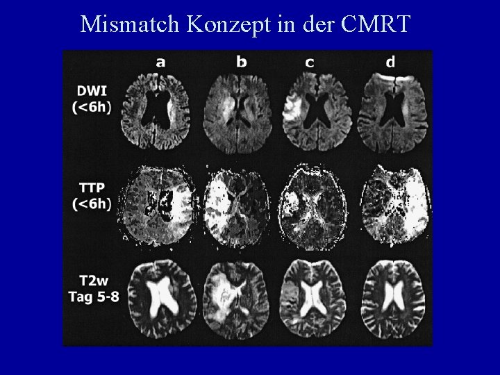 Mismatch Konzept in der CMRT 