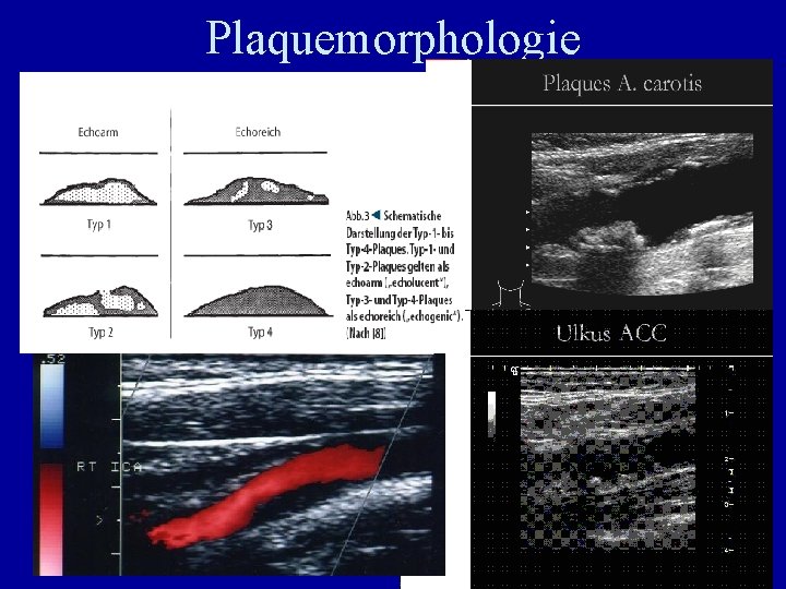 Plaquemorphologie 