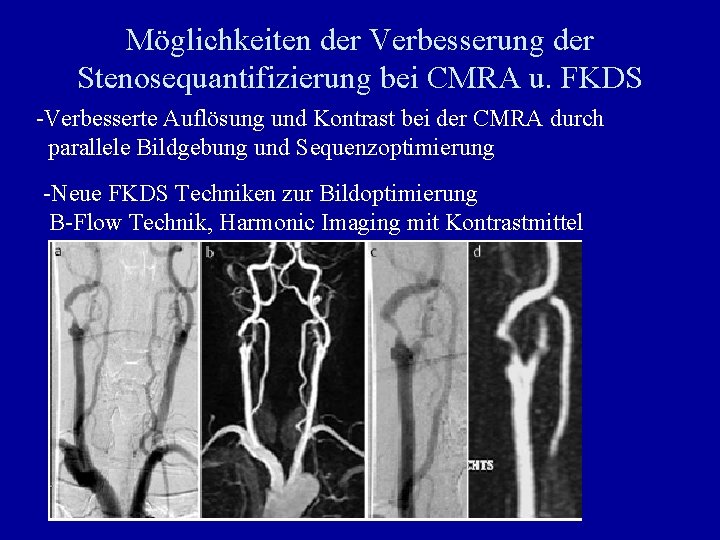 Möglichkeiten der Verbesserung der Stenosequantifizierung bei CMRA u. FKDS -Verbesserte Auflösung und Kontrast bei